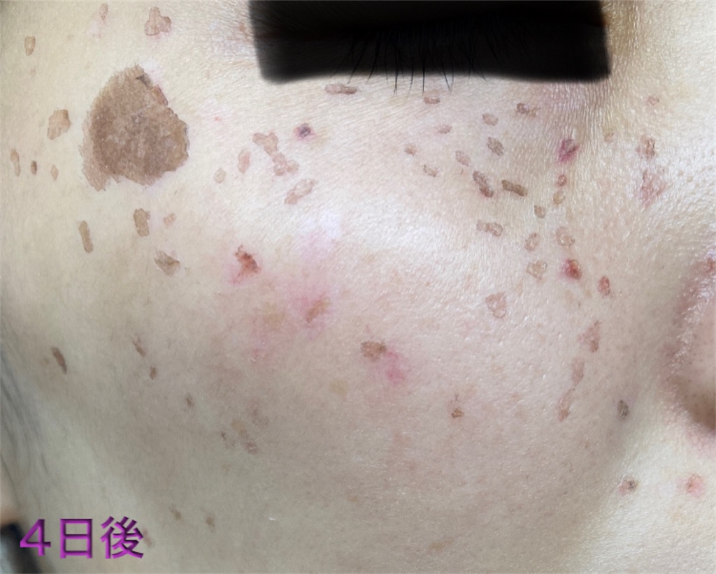 f:id:biyouskin:20211230150443j:image f:id:biyouskin:20211230150443j:image