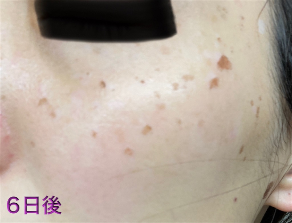 f:id:biyouskin:20211230150553j:image f:id:biyouskin:20211230150553j:image