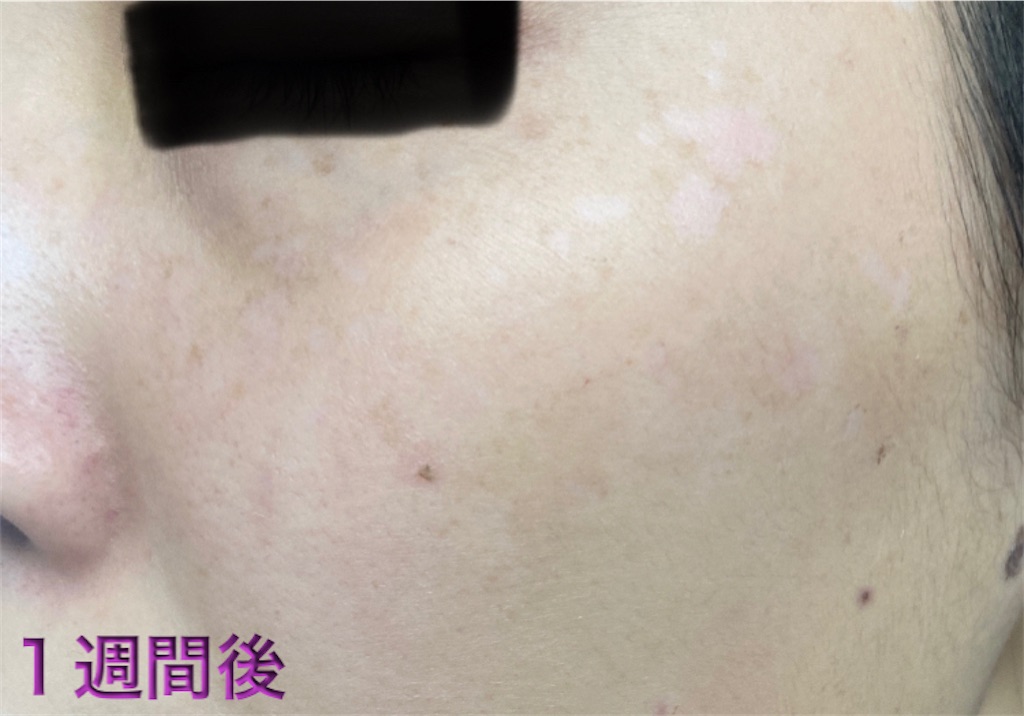 f:id:biyouskin:20211230150633j:image f:id:biyouskin:20211230150633j:image