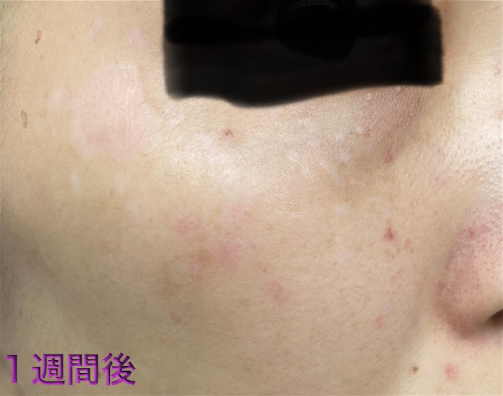 f:id:biyouskin:20211230150636j:image f:id:biyouskin:20211230150636j:image