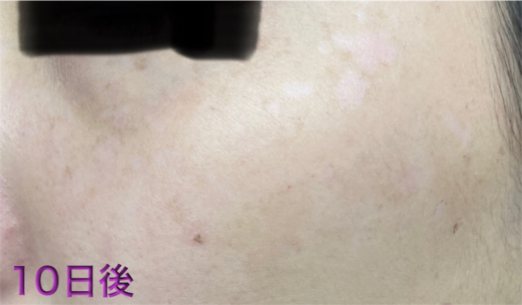 f:id:biyouskin:20220104233603j:image f:id:biyouskin:20220104233603j:image
