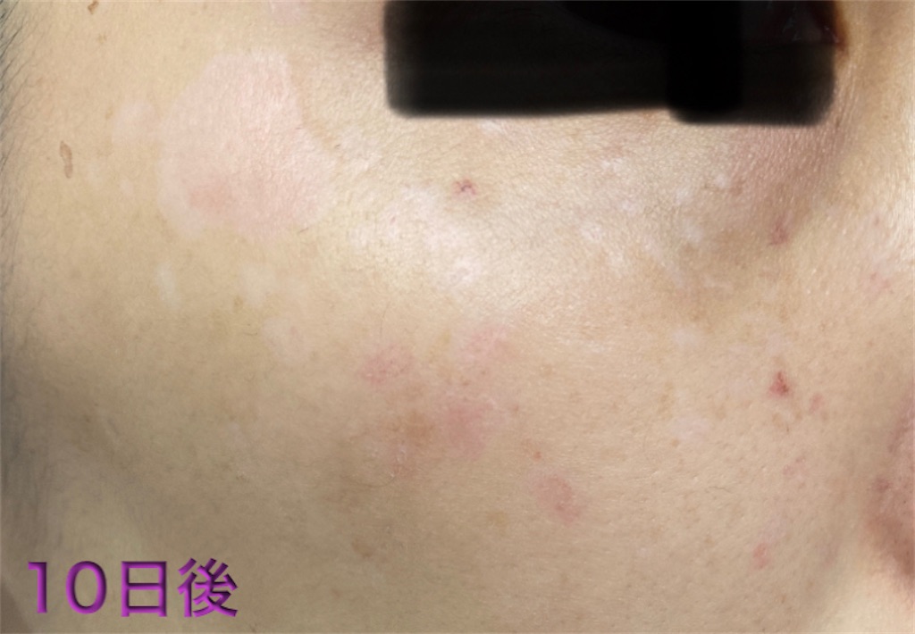 f:id:biyouskin:20220104233606j:image f:id:biyouskin:20220104233606j:image