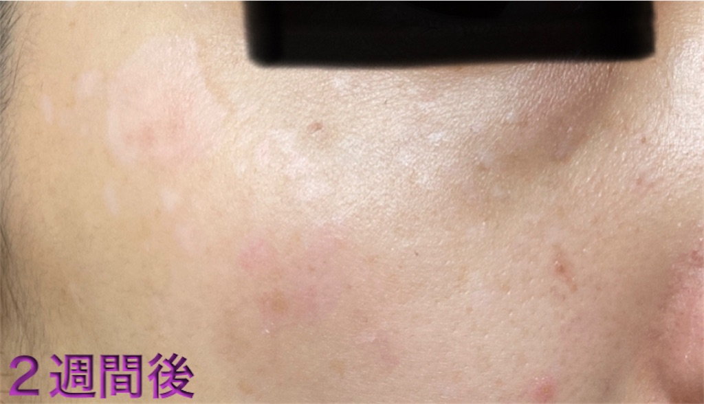 f:id:biyouskin:20220104233627j:image f:id:biyouskin:20220104233627j:image