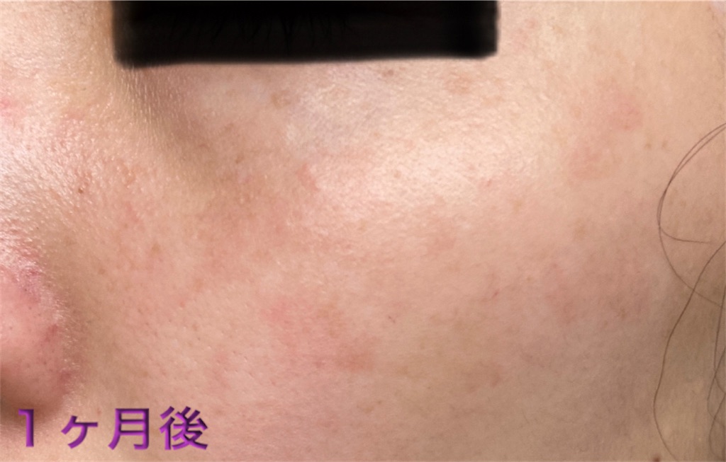 f:id:biyouskin:20220104233656j:image f:id:biyouskin:20220104233656j:image