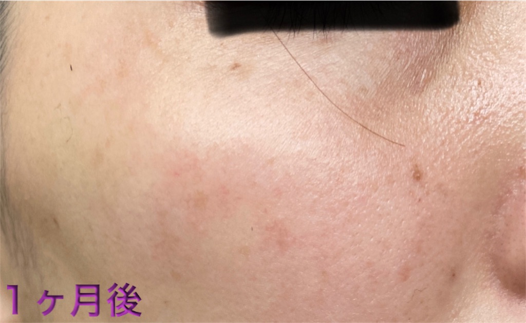 f:id:biyouskin:20220104233658j:image f:id:biyouskin:20220104233658j:image