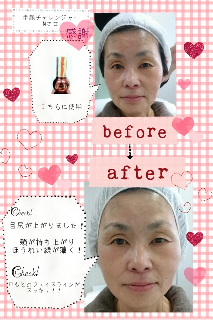 f:id:blanc-fee:20161210160918j:plain f:id:blanc-fee:20161210160918j:plain