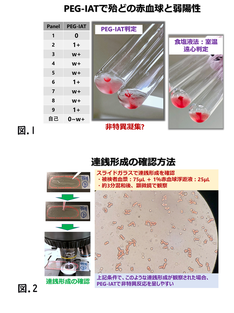f:id:bloodgroup-tech:20200119110818j:plain
