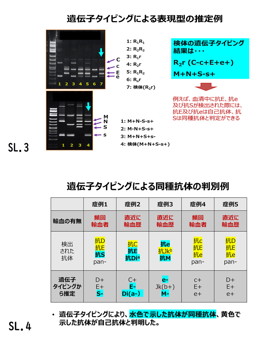 遺伝子型と表現型: それらが何であるか、そしてその特徴を理解する