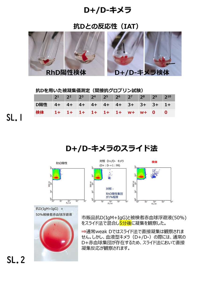 #086:RhD陽性とRhD陰性の血液型キメラの鑑別の(はてな?) - 血液型検査のサポートBlog