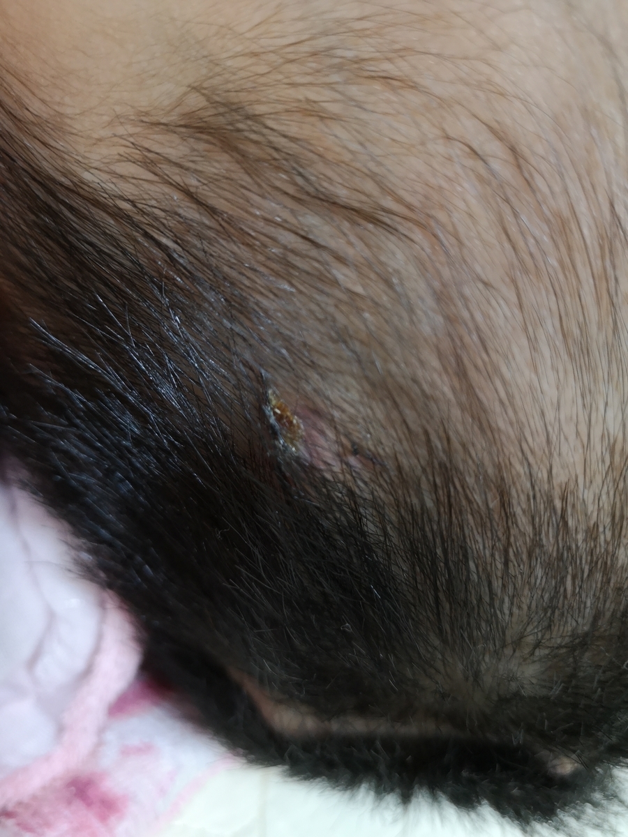 f:id:blooming_climbing:20191001031101j:plain
