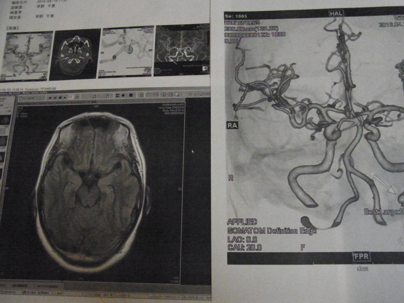 f:id:bob0524:20160601185700j:image:w360 f:id:bob0524:20160601185700j:image:w360