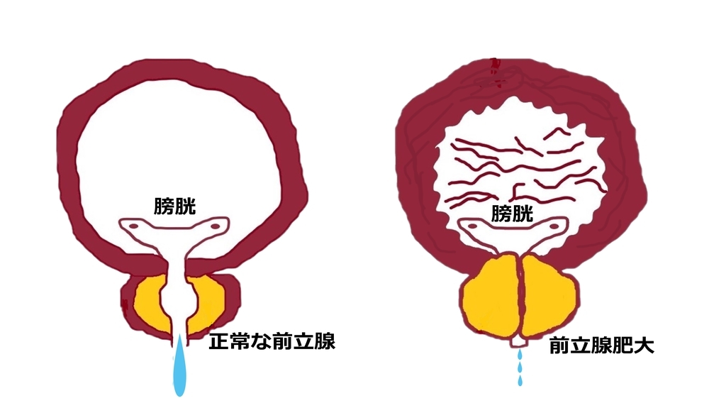 f:id:bobyons:20181106112243j:plain