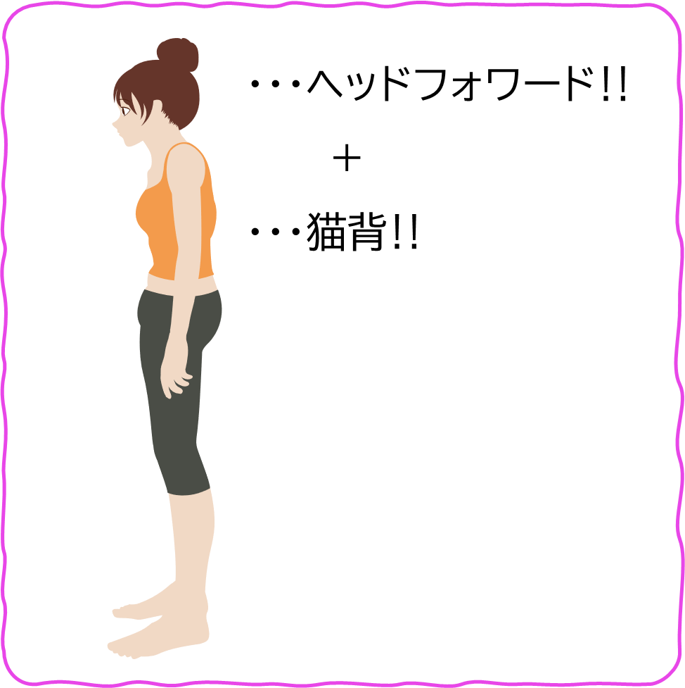 ヘッドフォワードと猫背のイラスト