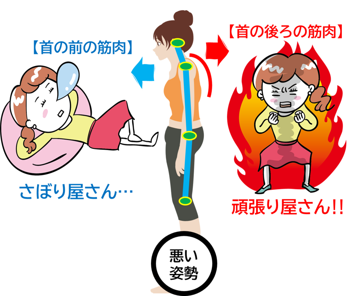 首の前の筋肉が予約、首の後ろの筋肉が強いイラスト