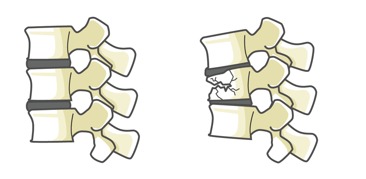 f:id:bodymakerpt:20191117191013j:plain f:id:bodymakerpt:20191117191013j:plain