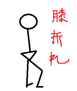 異常歩行 膝折れに備えよう 膝折れの原因とリハビリと理学療法 姿勢とボディメイクを考える