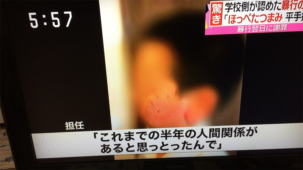 f:id:bokento:20151215192401j:plain
