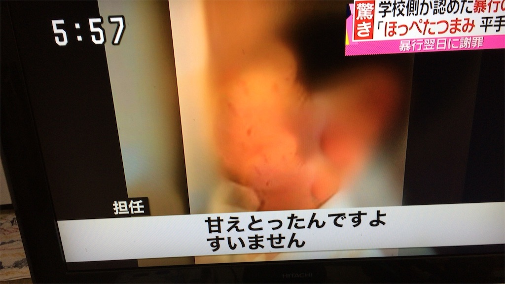 f:id:bokento:20151215192405j:plain