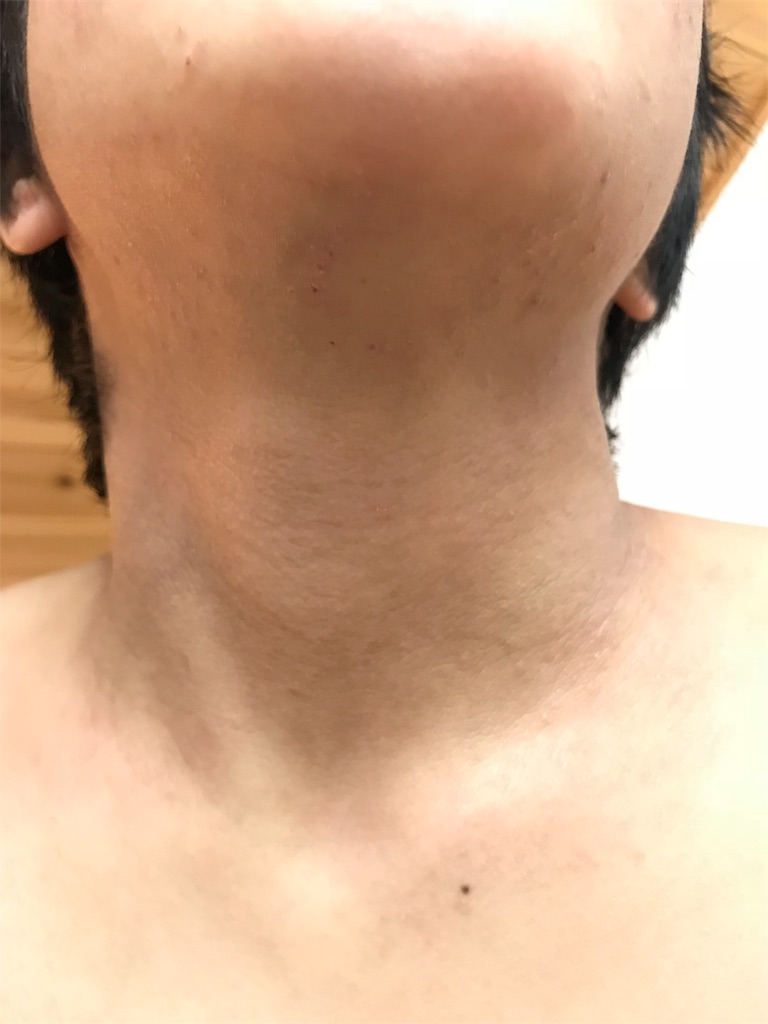 f:id:bokunokiroku:20190205213436j:image
