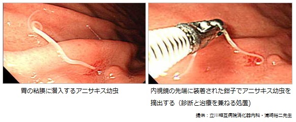 f:id:bontosyougatu:20171231121207j:plain