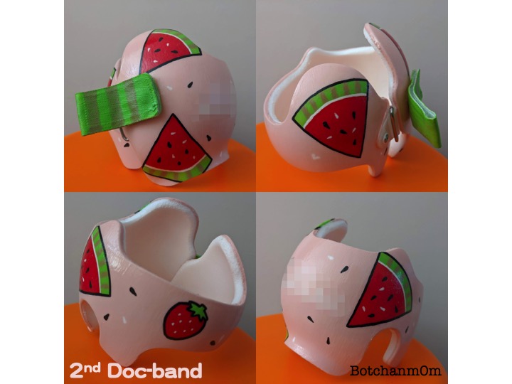 治療感ゼロで可愛さアップ ヘルメットを自分でデコレーション 子育て向いてないぼっちゃんママの研究記録