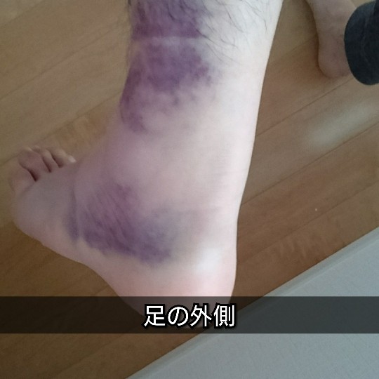 f:id:bousoukobito:20190530052655j:plain f:id:bousoukobito:20190530052655j:plain