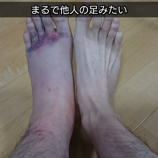 f:id:bousoukobito:20190530194727j:plain f:id:bousoukobito:20190530194727j:plain