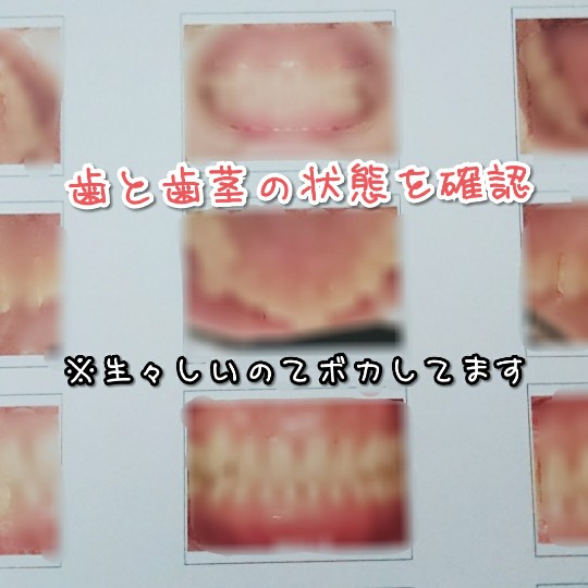 f:id:bousoukobito:20190717051506j:plain f:id:bousoukobito:20190717051506j:plain