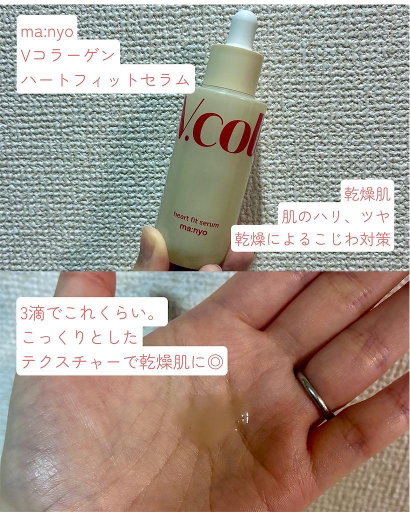 f:id:bpiyoko:20260303143038j:image