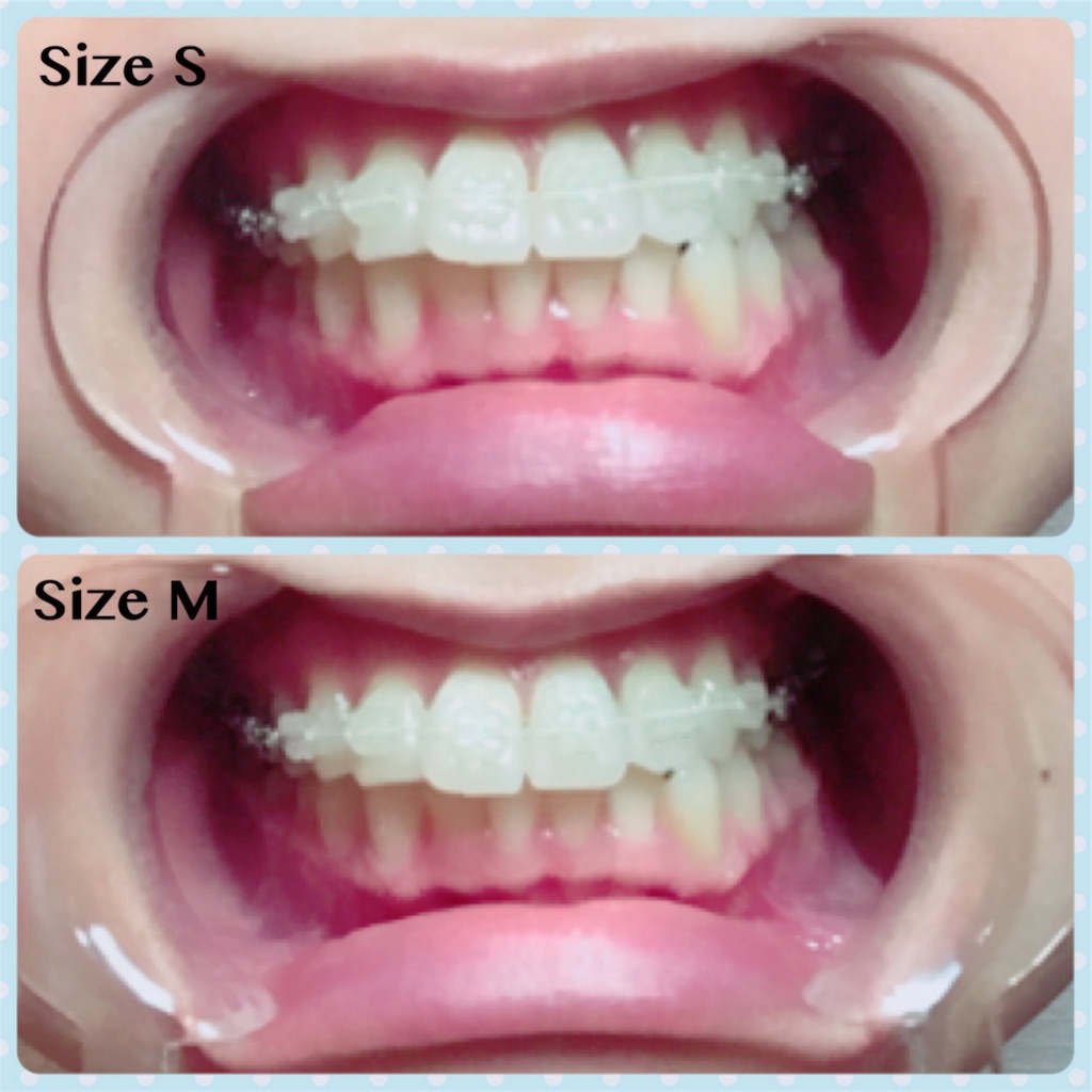 f:id:braces31:20170730221546j:image f:id:braces31:20170730221546j:image