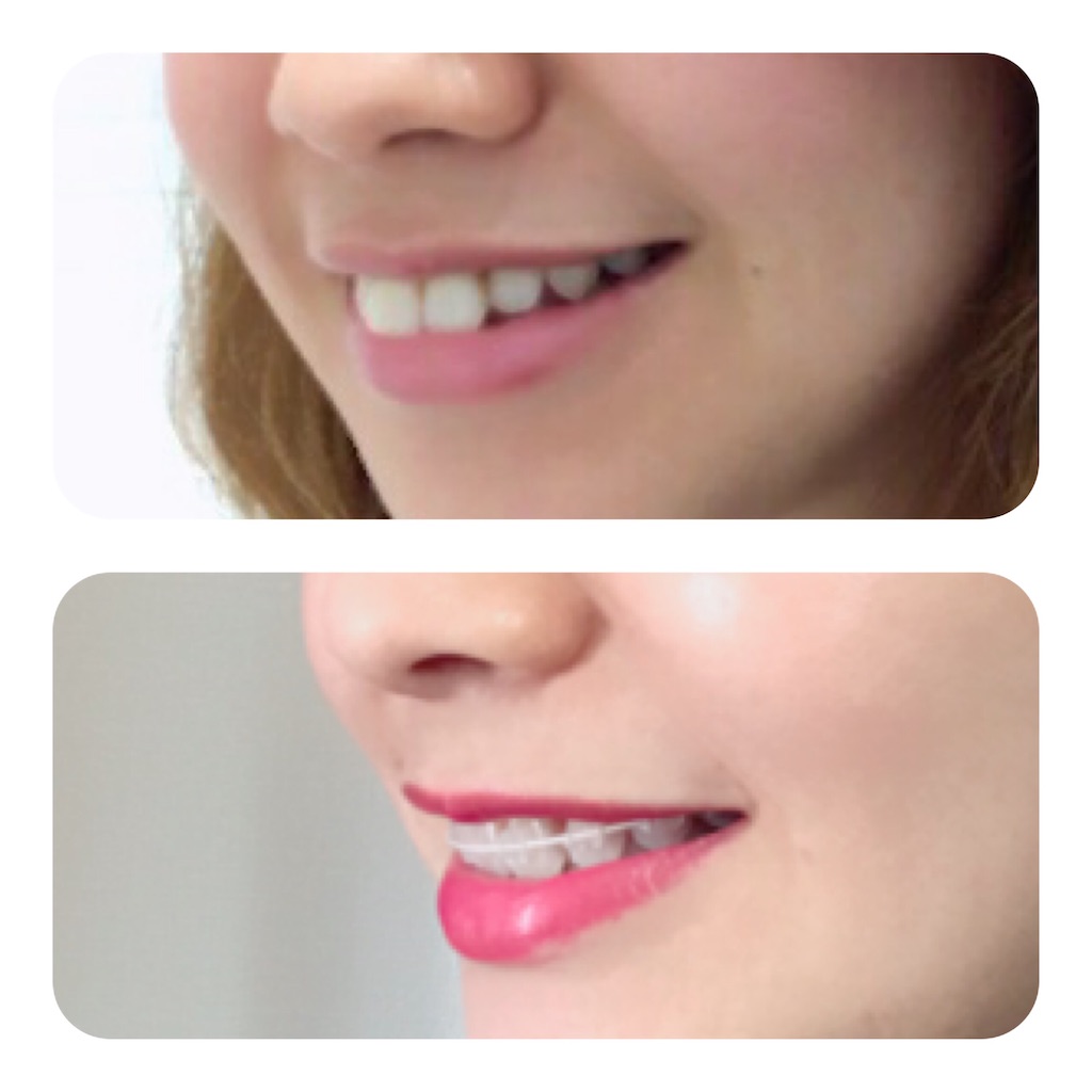 f:id:braces31:20191231125711j:image f:id:braces31:20191231125711j:image