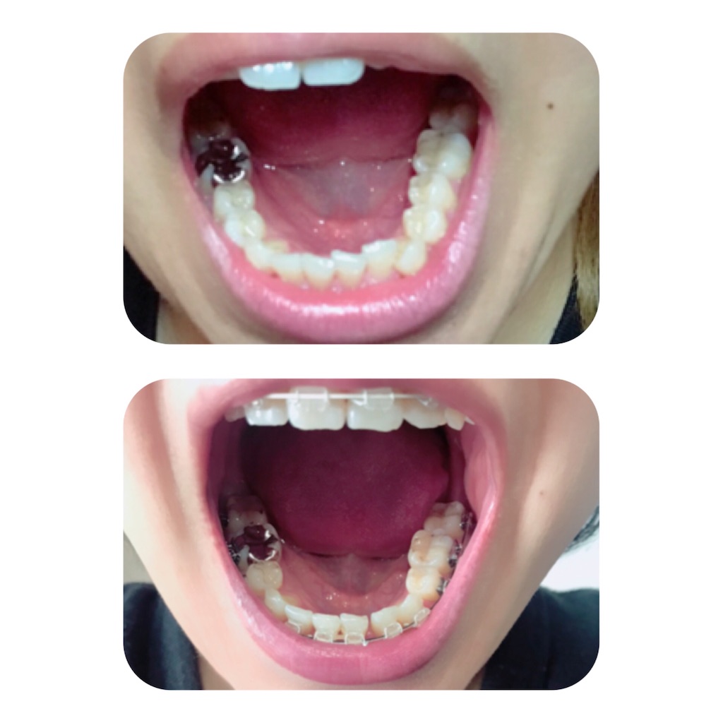 f:id:braces31:20191231130404j:image f:id:braces31:20191231130404j:image