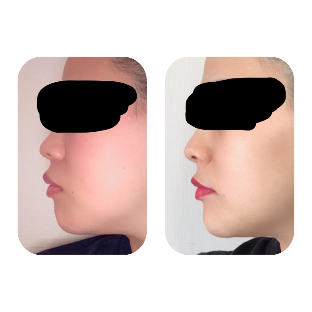 f:id:braces31:20191231130925j:image f:id:braces31:20191231130925j:image