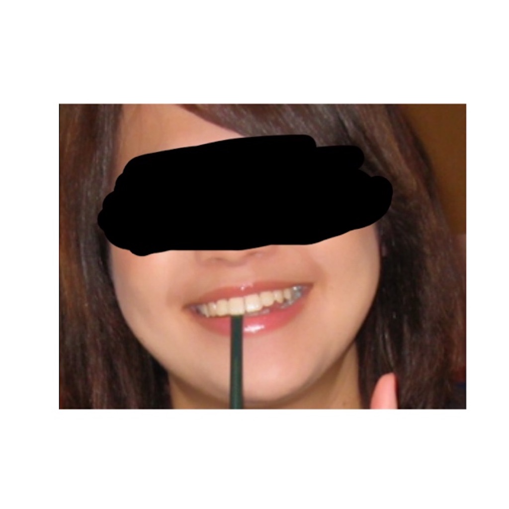 f:id:braces31:20201004164756j:image