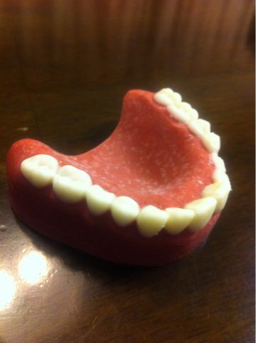 チョコと入れ歯の作り方 浦安市 新浦安の評判の歯医者 新浦安ブライト歯科が誇るドクター陣によるブログ