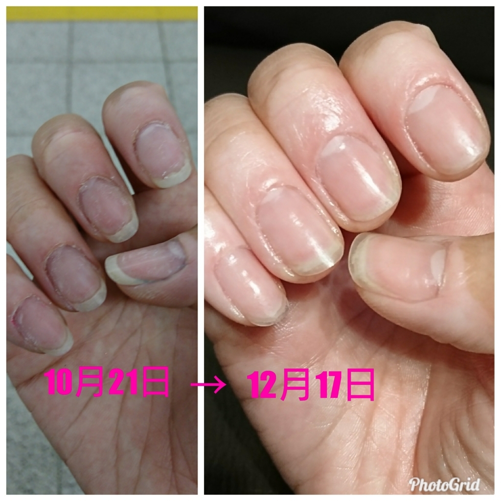 f:id:bu-621:20171217205608j:plain:w300