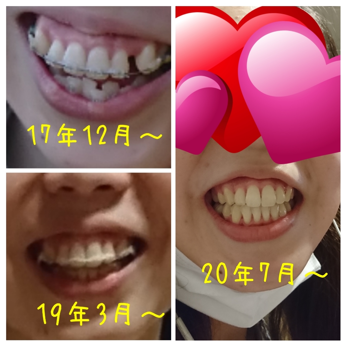 f:id:bu-621:20200703231004j:plain:w400