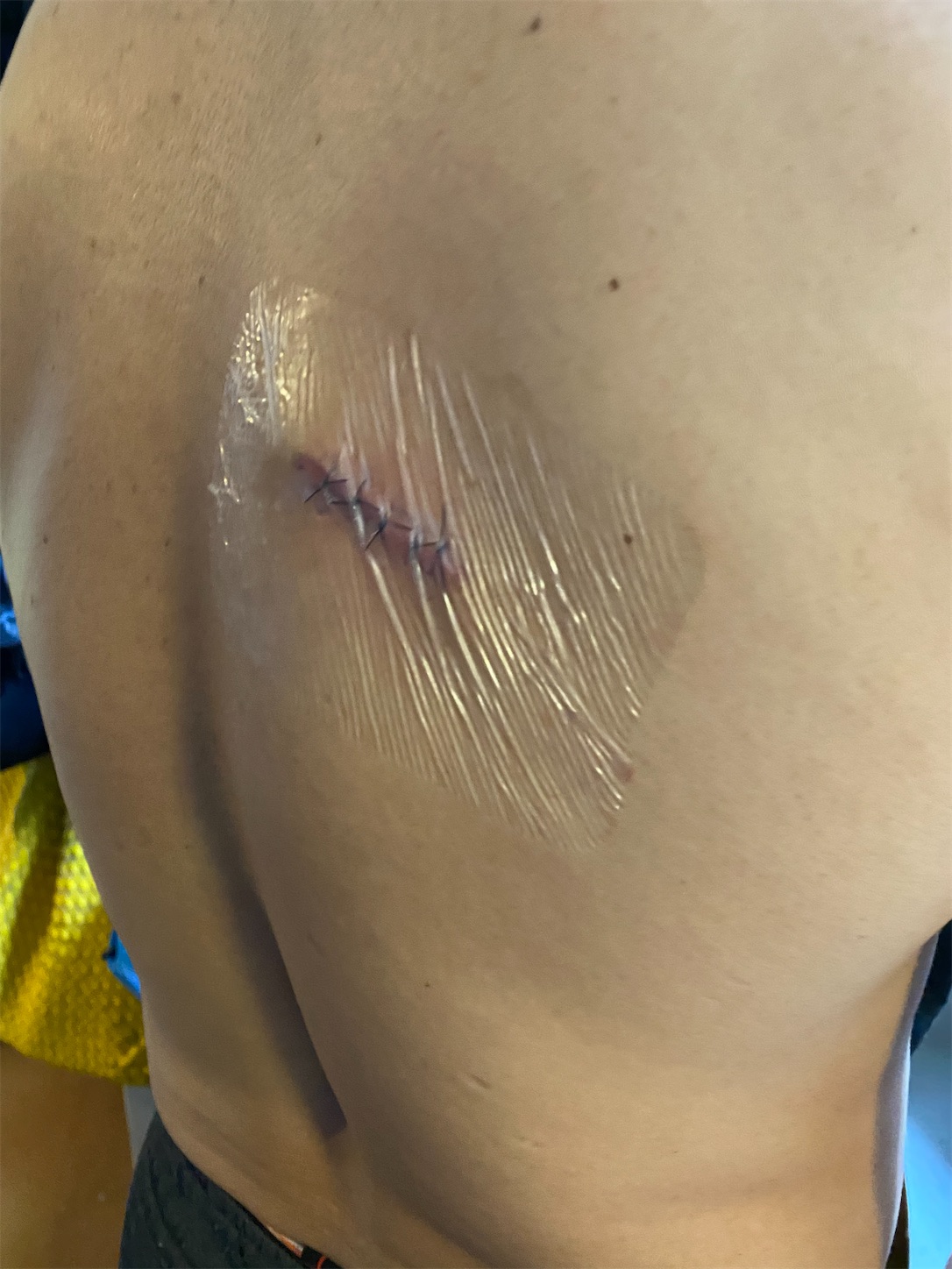 f:id:bucyoub51:20200312174619j:image