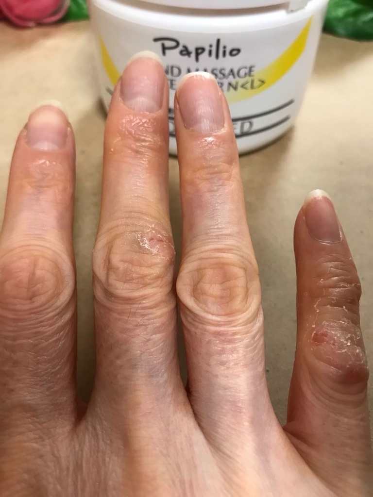 f:id:buildingdragons:20190109164922j:plain f:id:buildingdragons:20190109164922j:plain