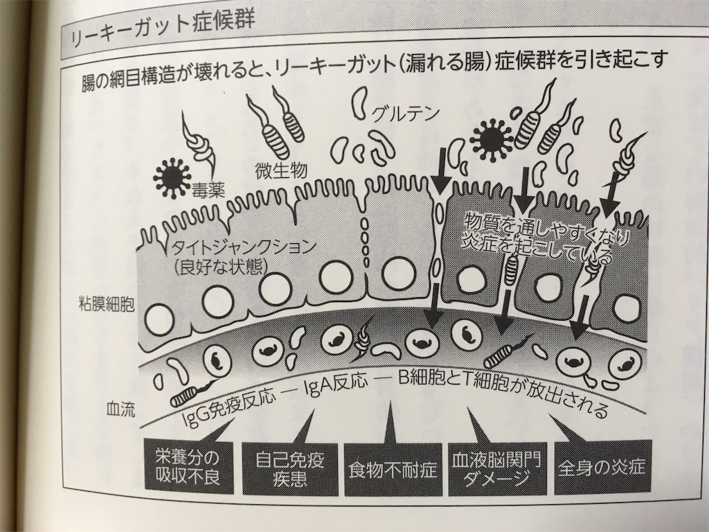 f:id:bunox:20190924224129j:plain