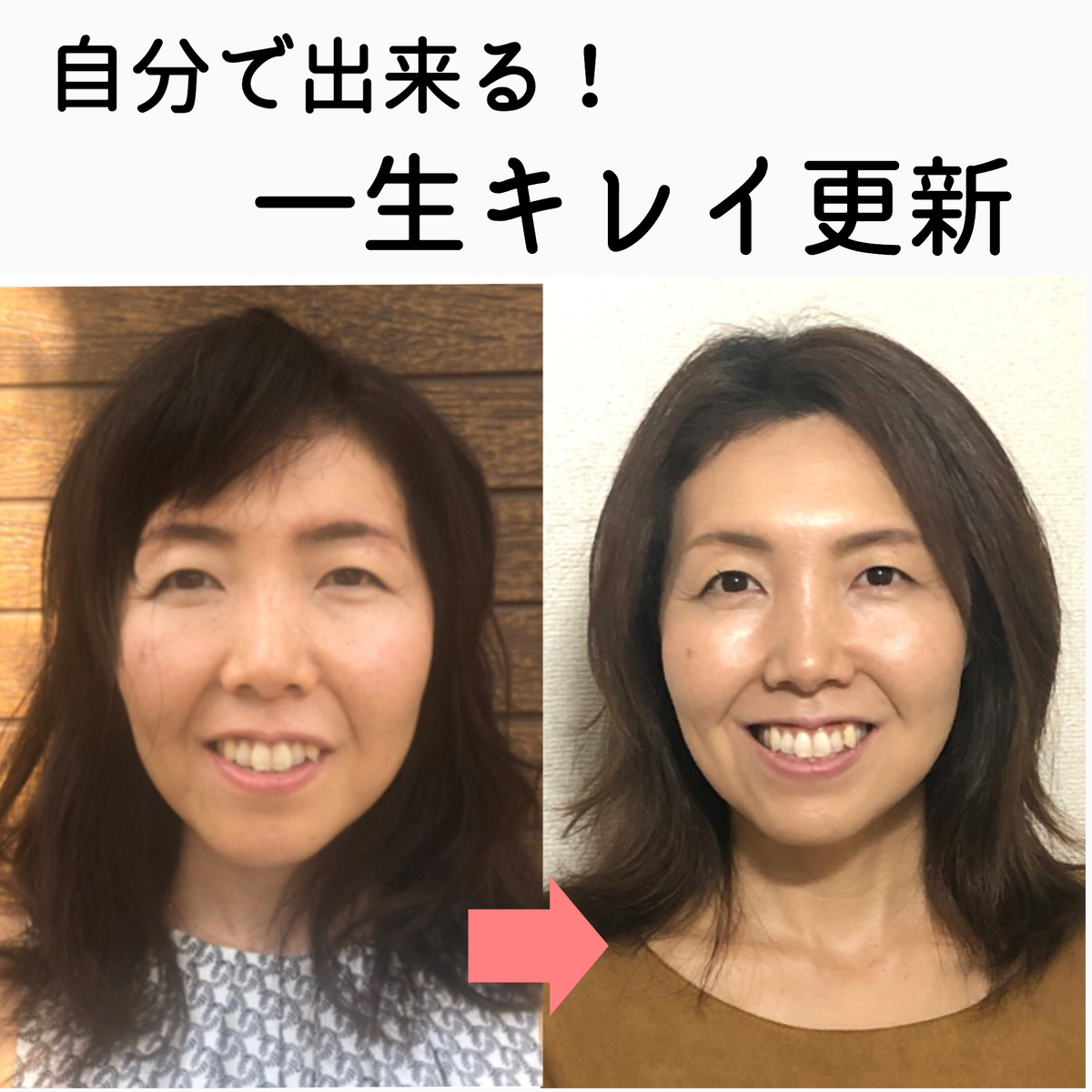 骨活ビフォーアフター3