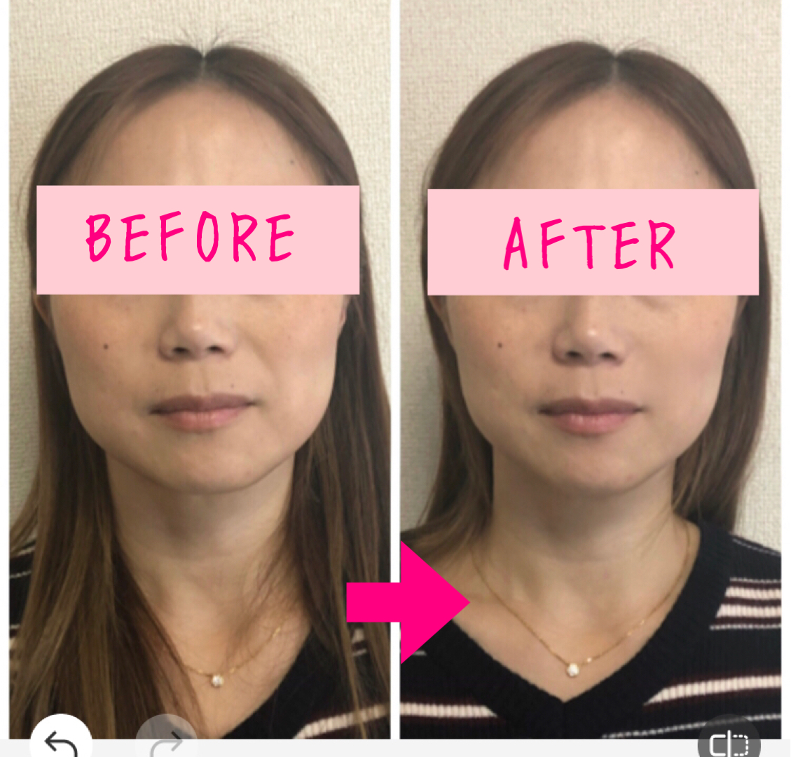 骨活ビフォーアフター2
