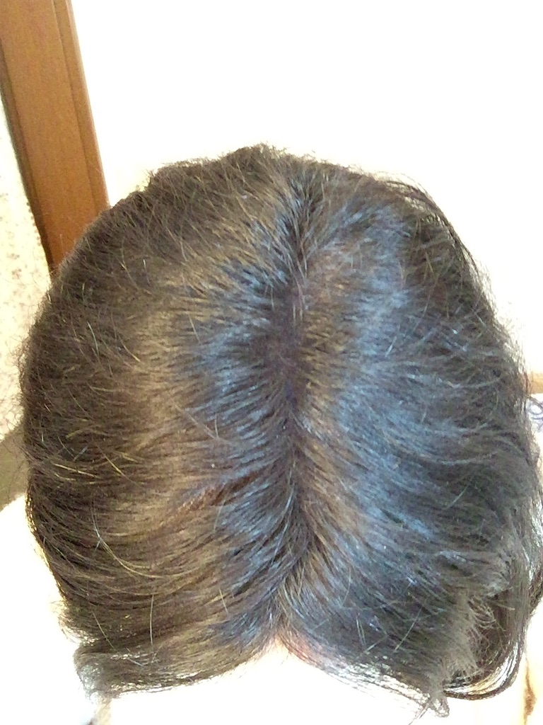 スーパーミリオンヘアーとは 一般の人気 最新記事を集めました はてな