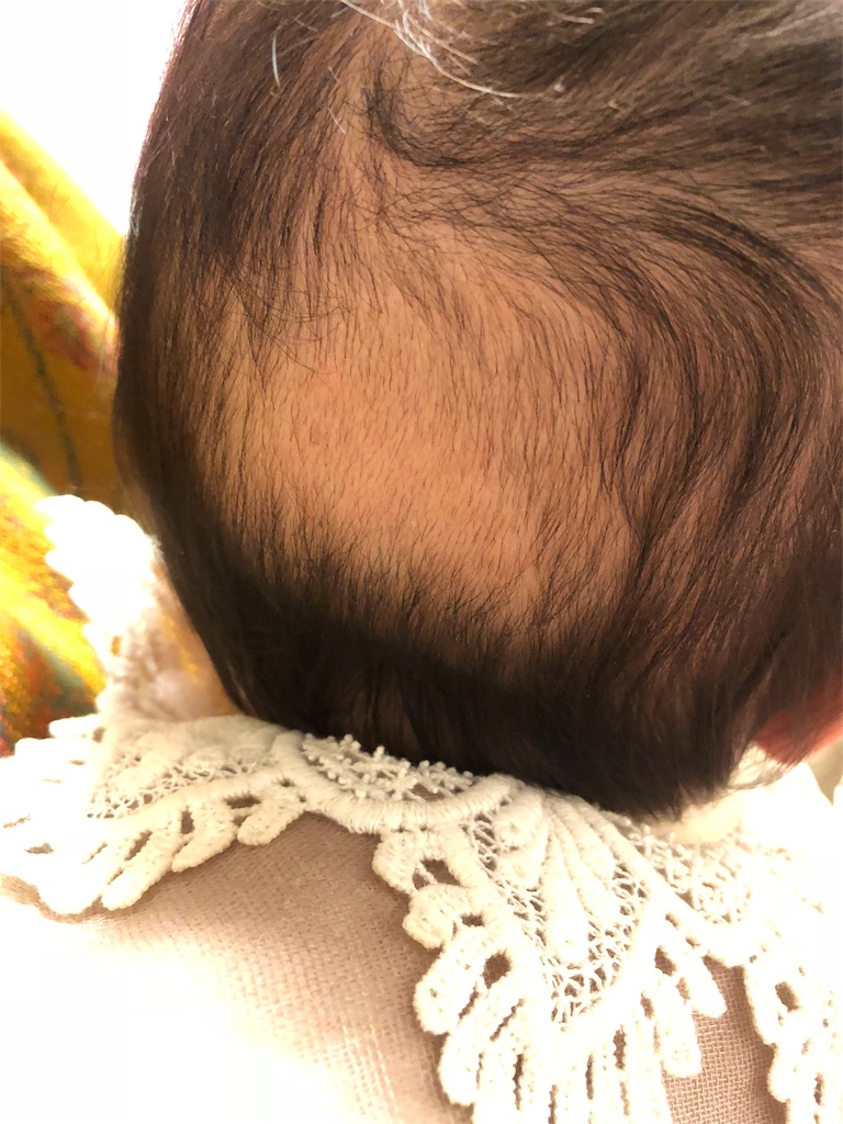 f:id:ca-san_diary:20180118132547j:image