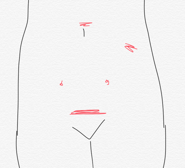 f:id:callemanila:20181121210529j:plain