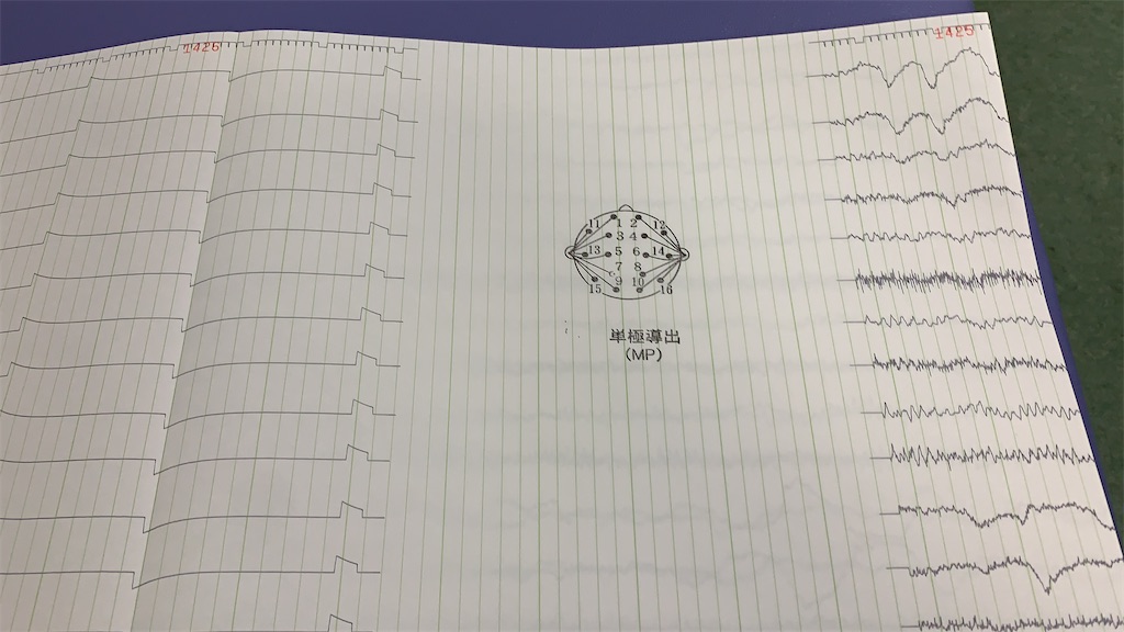 f:id:camelstation:20200303030111j:plain