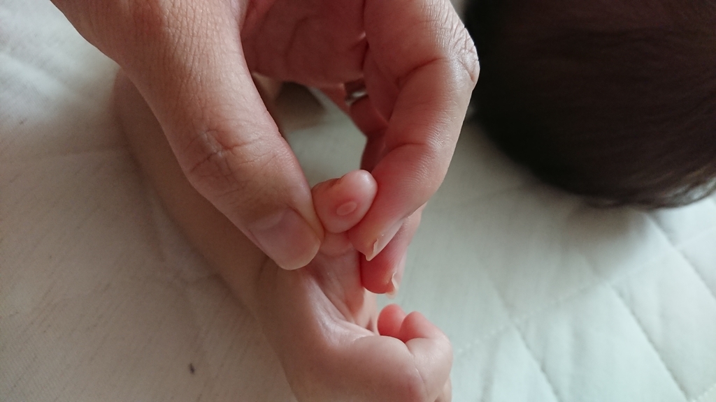 手足口病?ヘルパンギーナ?違いは?赤ちゃん 初めての病気 生後10ヶ月
