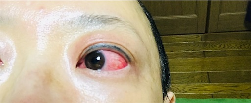 f:id:carllewico_yu221:20190720111721j:image f:id:carllewico_yu221:20190720111721j:image