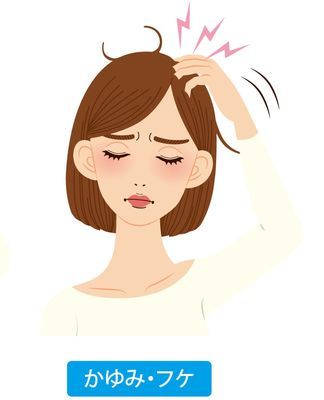 フケがでる原因は 脂性or乾燥 低刺激シャンプー比較 髪の悩み に年齢を感じさせない ツヤ髪のつくり方