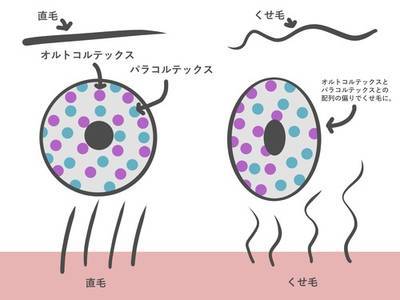 １短く切って広がるくせ毛に